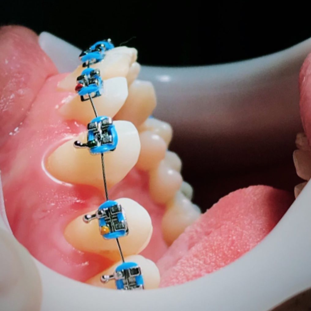 Rodrigues Odontologia Especializada Ortodontia #1.E